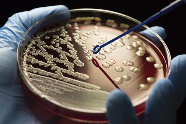 افزایش ظهور اَبَر میکروب ها: مقابله با بحران مقاومت آنتی بیوتیکی